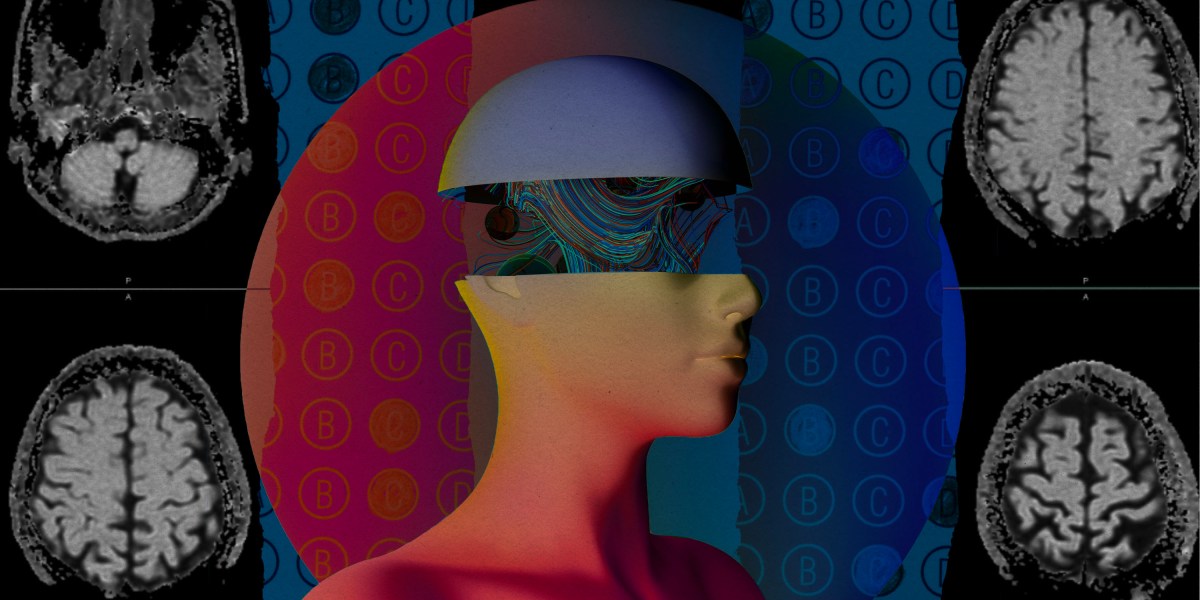 Radiologist and team debating AI scan output in busy hospital ward